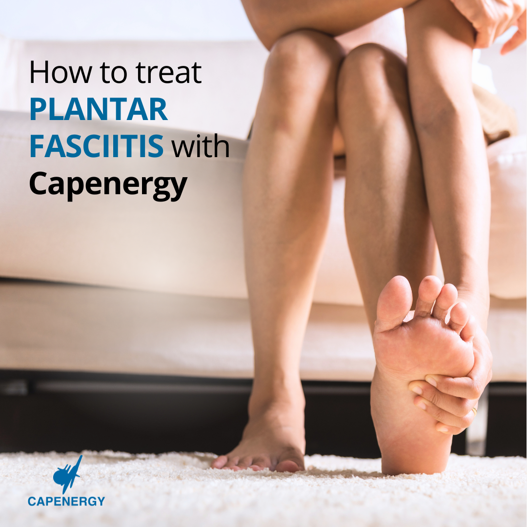 Treatment of plantar fasciitis with Capenergy