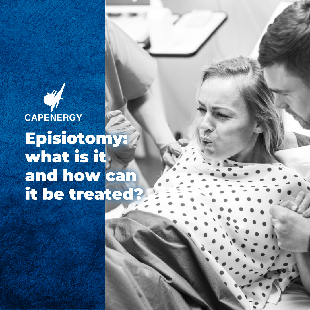 Episiotomy and its treatment with Capenergy radiofrequency
