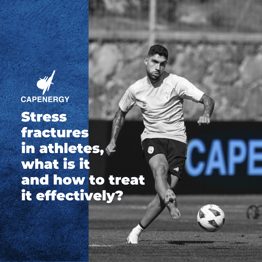 Stress fractures in athletes, what are they and how to treat them efficiently?