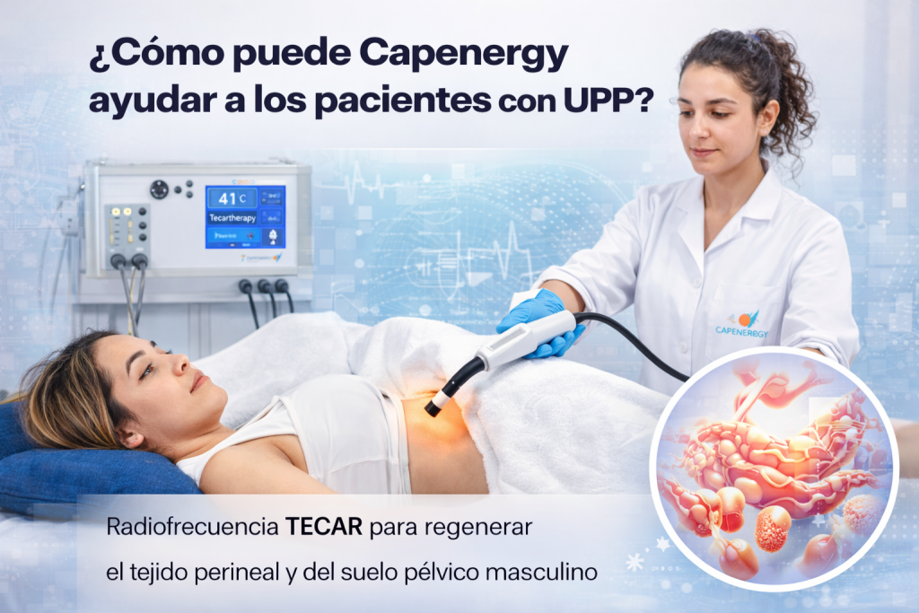 Ilustración del tratamiento no invasivo con radiofrecuencia TECAR de Capenergy para la incontinencia urinaria tras prostatectomía radical, mostrando paciente, zona pélvica y equipo terapéutico