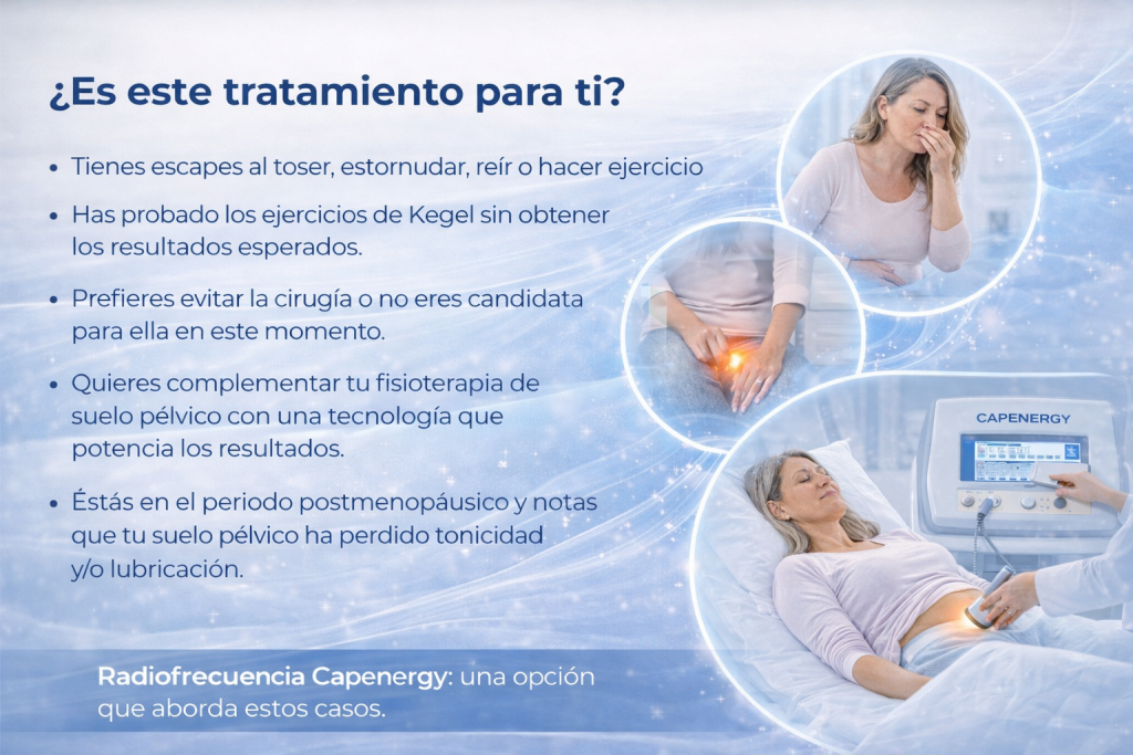 Imagen informativa sobre cuándo la radiofrecuencia puede ser una opción para mujeres con incontinencia urinaria de esfuerzo y debilidad del suelo pélvico