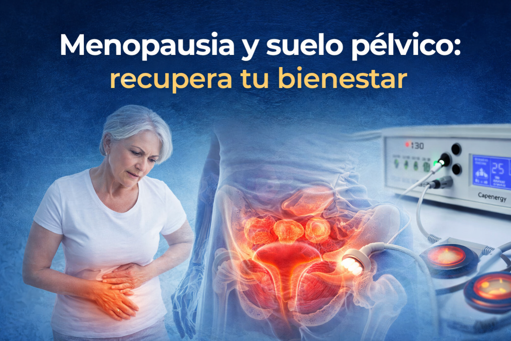 Menopausia y suelo pélvico: recuperación del bienestar íntimo con radiofrecuencia Capenergy