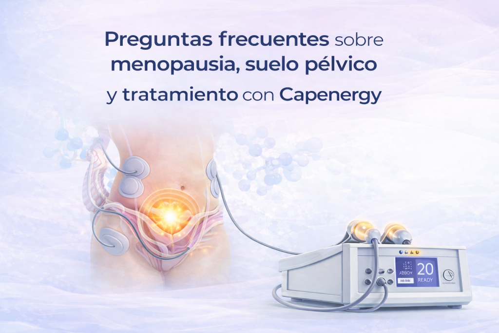 Preguntas frecuentes sobre menopausia, suelo pélvico y tratamiento con radiofrecuencia Capenergy